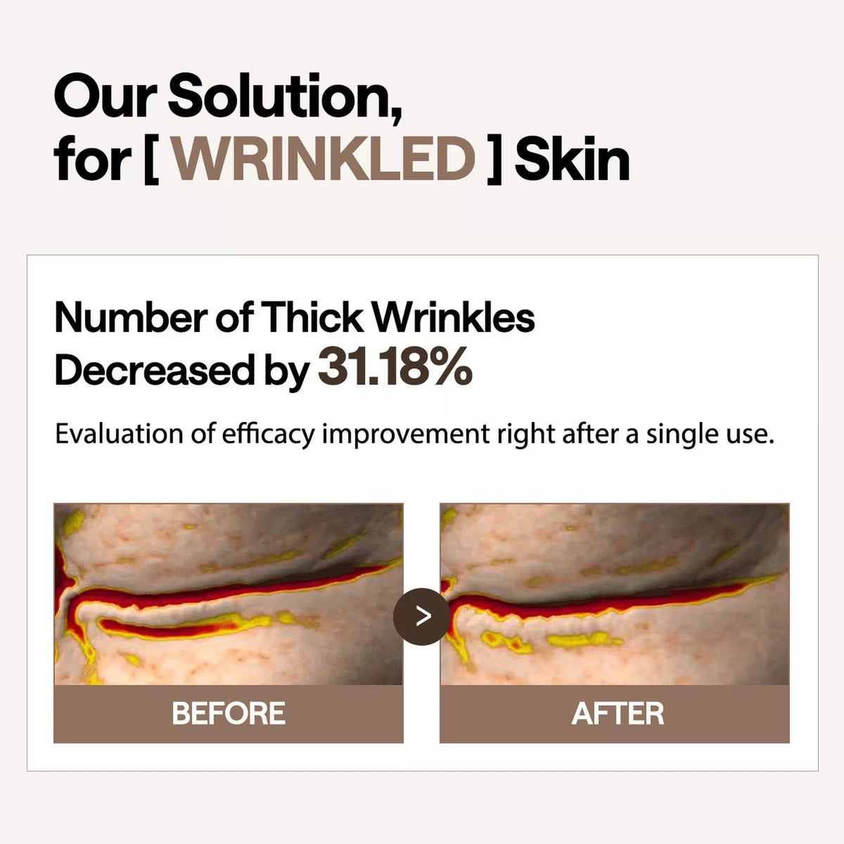 Retinol & Collagen Ampoule Patch