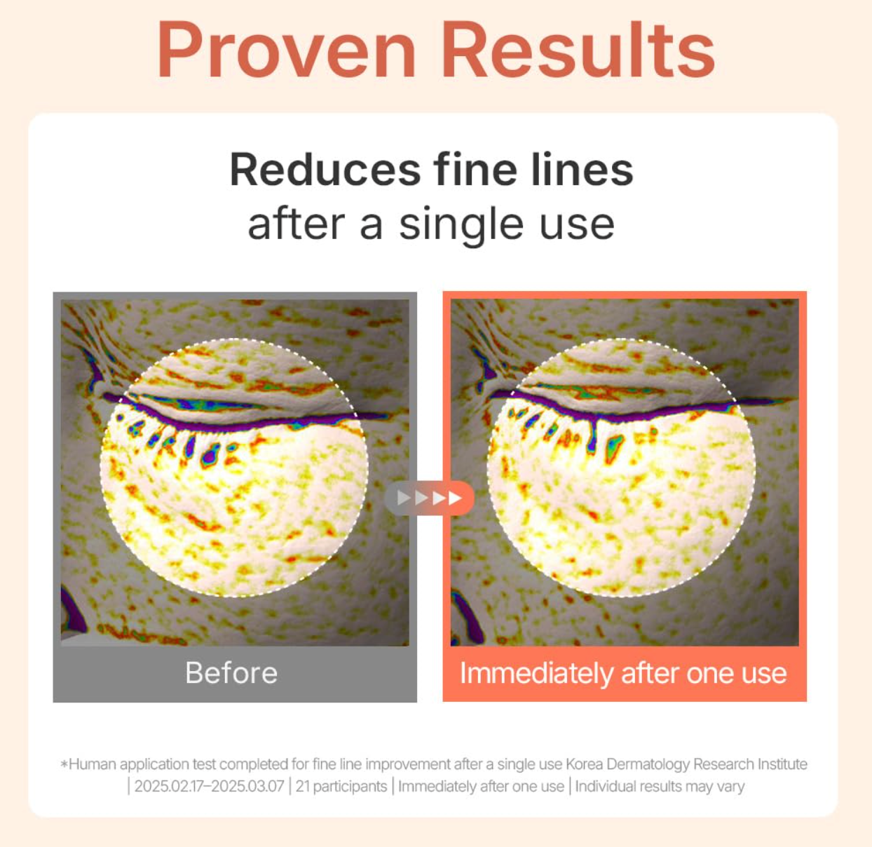 PDRN Skin Tightening 5Pc Glow Gel Mask