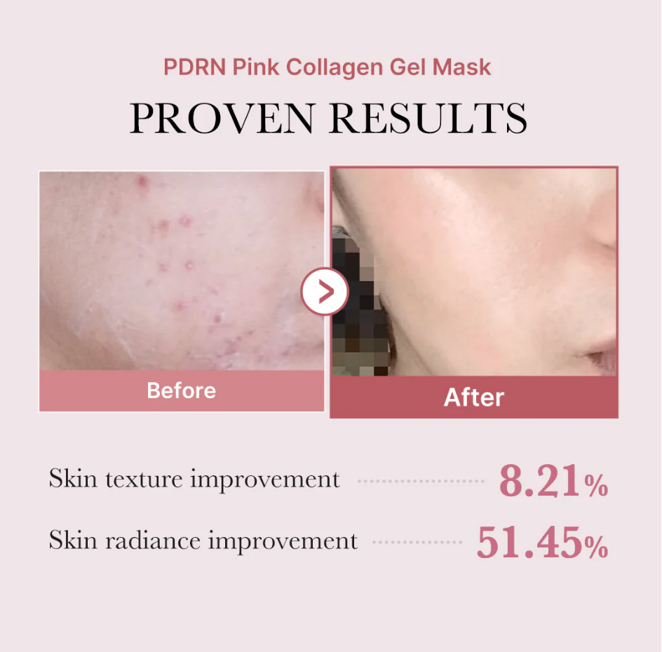 Medicube Salmon PDRN Pink Collagen Jelly Gel Mask