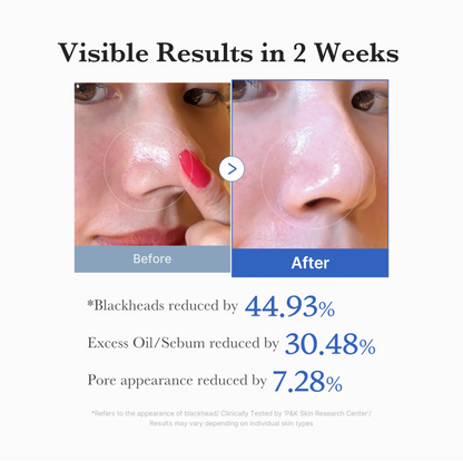 Medicube Zero Pore Pads