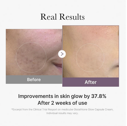 Medicube Age R Glutathione Glow Capsule Cream